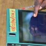BVAS