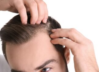 Symptoms And Causes Of Dandruff