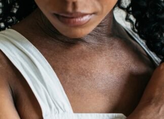 How You Can Prevent Eczema Eczema