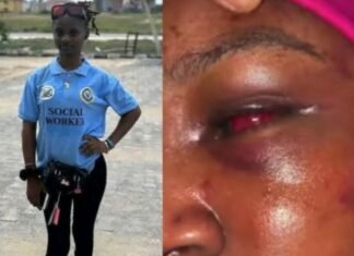 Nancy Narrates Ordeal As Police Allegedly Free Suspect Kadi In Viral Nak3d Assault Video